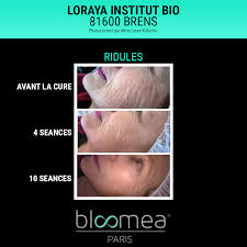blooméa 10 séances - SPECIALES RIDES OU CICATRICES 